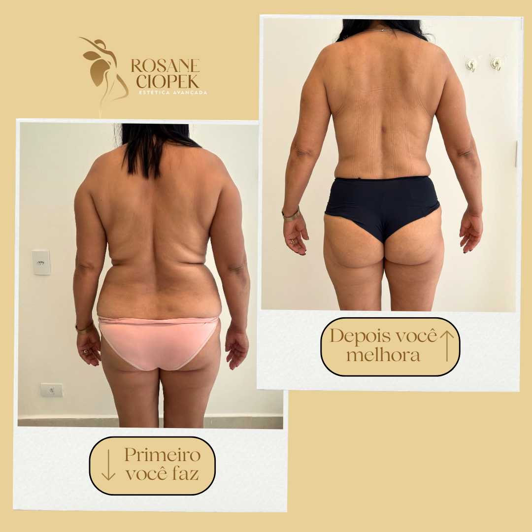 Resultado antes e depois do Método Ciopek 7